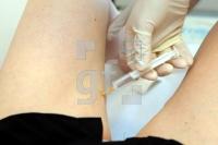 LG11_Botox02_0102.JPG